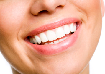 benefits of Invisalign - Winterpock, VA